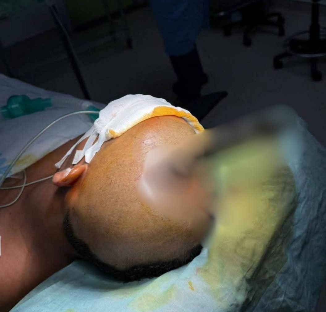 Stabbing victim Guyana